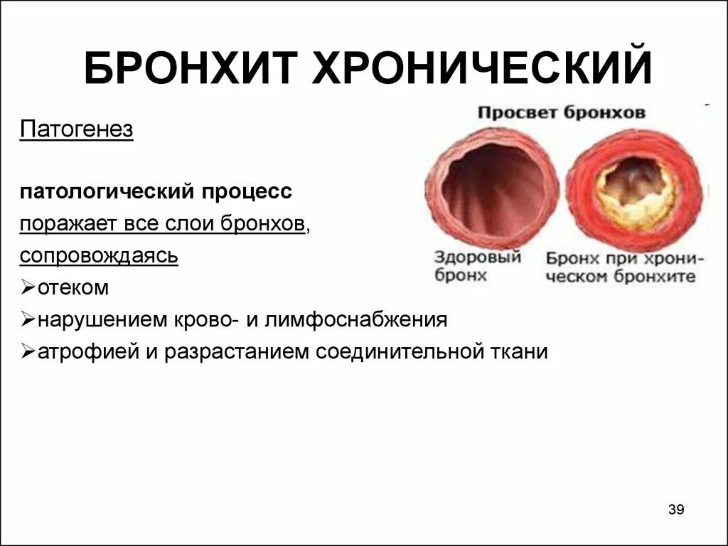 Поражение бронхов острый бронхит. Острый хронический бронхит клинические симптомы. Острый катаральный бронхит симптомы. Хронический воспалительный процесс в бронхах (бронхит). У ребенка легкий бронхит