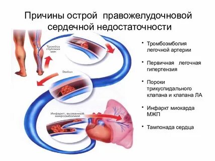 Острая сосудистая недостаточность кровообращения