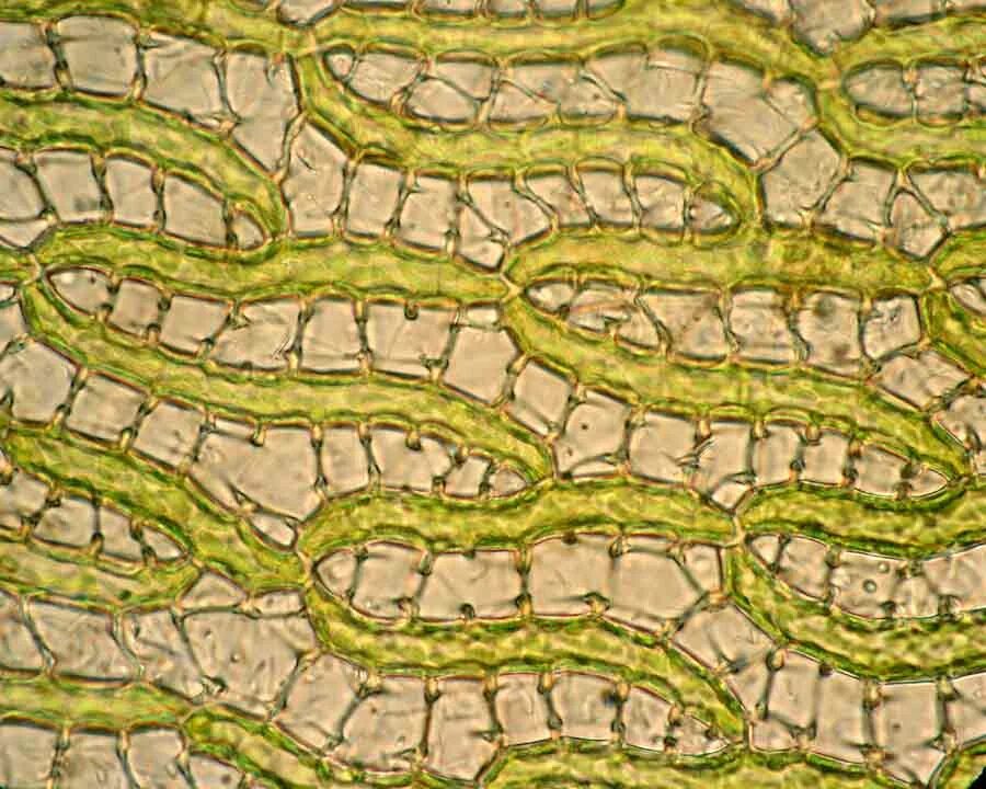 Водоносные клетки в листьях имеет. Мох сфагнум клетки листа под микроскопом строение. Мох сфагнум клетки листа под микроскопом. Хлорофиллоносные клетки листа. Клетки листа мха мниума препарат.