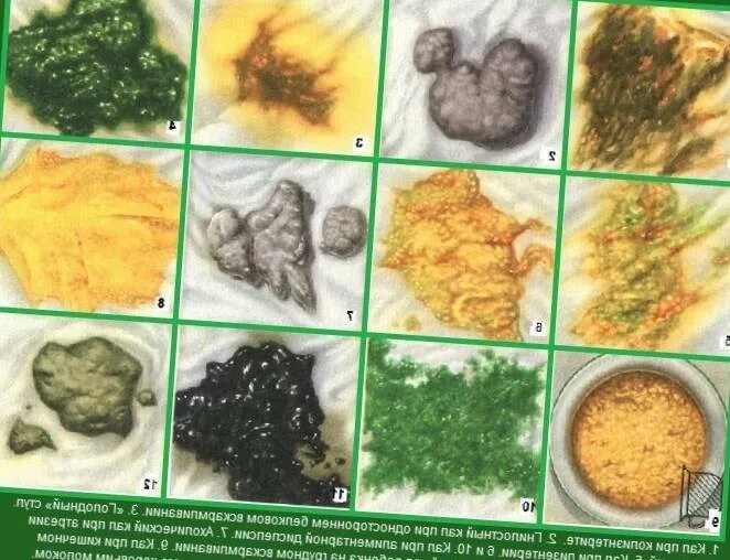 синдром хронической диареи классификация. острая диарея у взрослых симптомы. причины развития диареи. диарея инфекционные болезни. острый понос у взрослого.