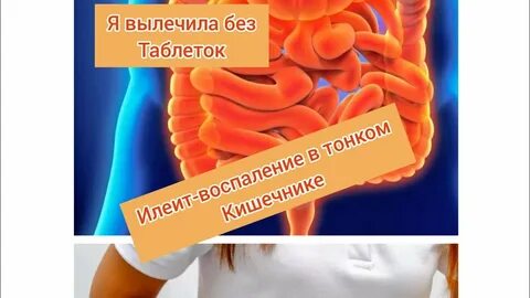 Илеит