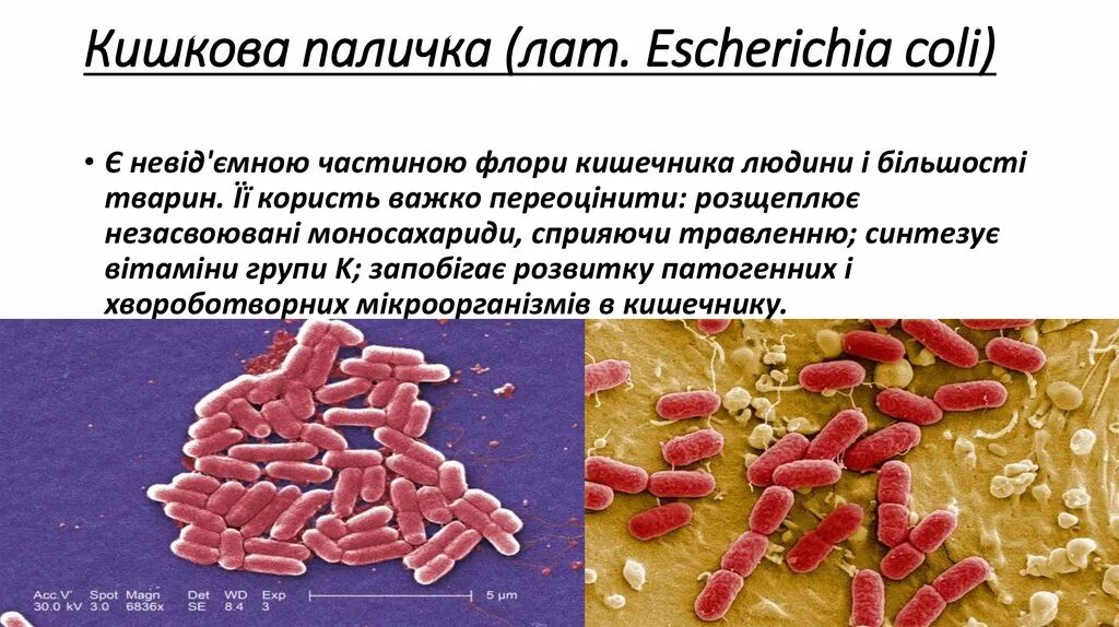 Гемолитические эшерихии. Escherichia coli что гемолизирующая. Эшерихия коли гемолитическая. Гемолитическая эшерихия колли. Escherichia coli что это у мужчин