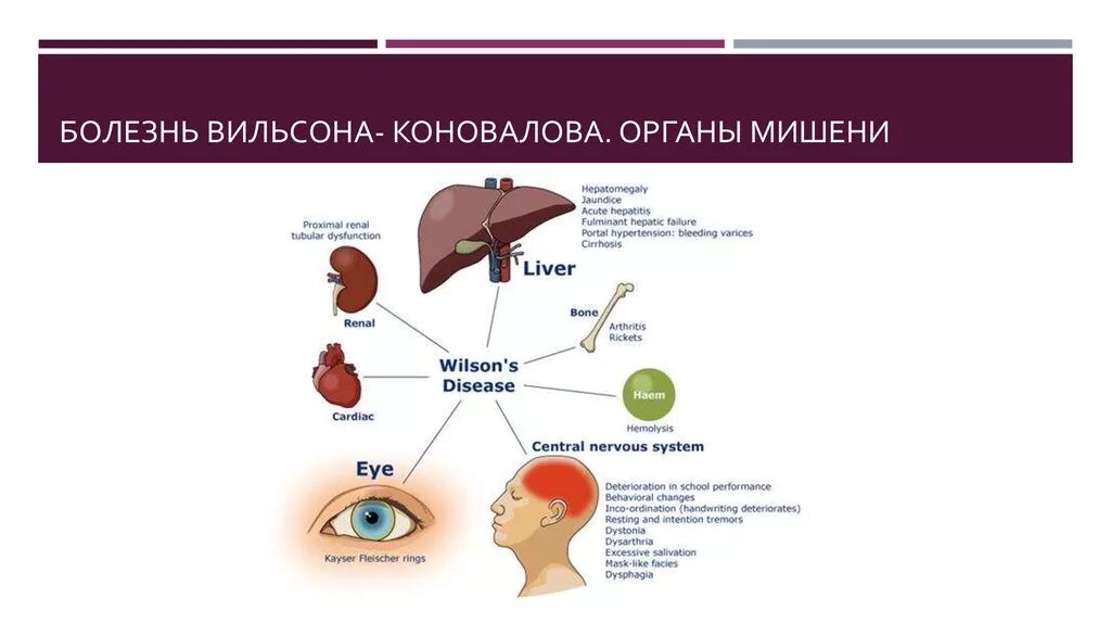 Органы мишени при болезни Вильсона Коновалова. Дрожательная форма болезни Вильсона. Болезнь Вильсона Коновалова клиника. Болезнь Вильсона Коновалова этиология. Синдром вильсона коновалова что это такое простыми