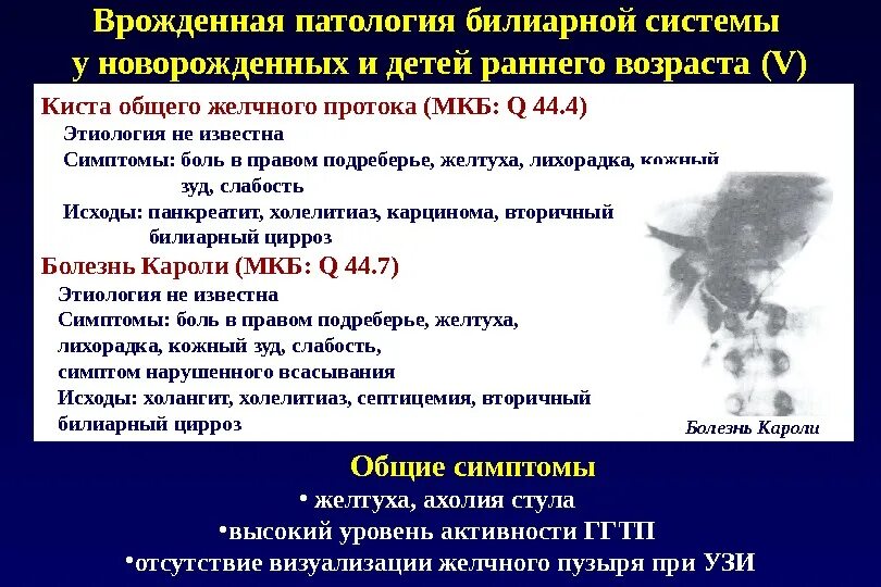 Что патология и тем. Патология билиарной системы. Патология билиарной системы у детей. Симптомы патологии билиарной системы. Поражение билиарной системы.