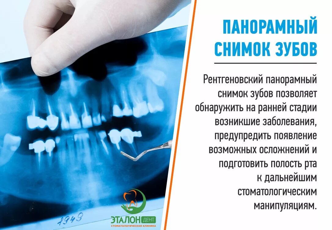 Где сделать кт зуба. Панорамный снимок зубов. Панорамные снимки зубов. Рентген зубов панорамный. Стоматология панорамный снимок зубов.