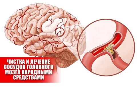 Сосуды головного средства