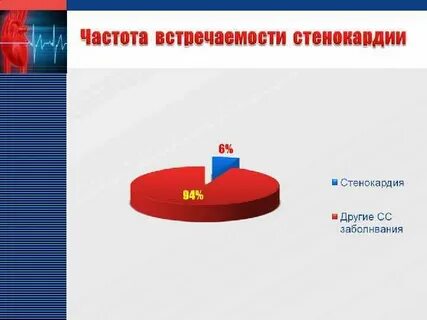 Инфаркт миокарда дипломная работа