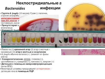 Неклостридиальная анаэробная инфекция