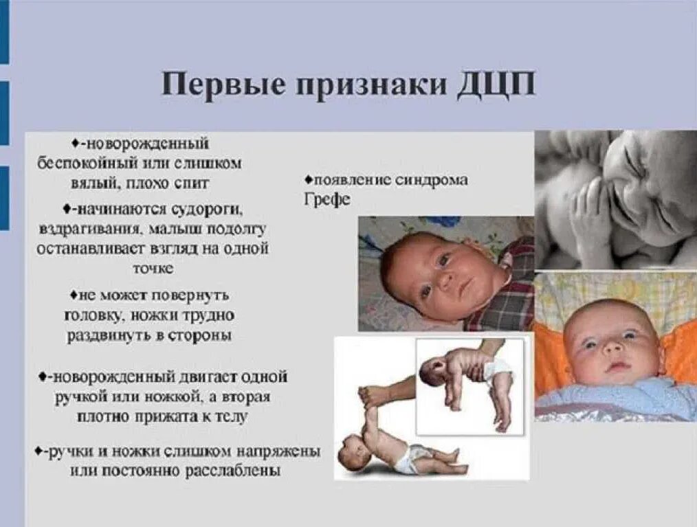 Болезнь на 3 месяца. Ранние признаки дцп у детей. дцп у новорожденных симптомы 2 месяца. дцп ранние признаки у новорожденного. дцп симптомы у детей до 1 года признаки.
