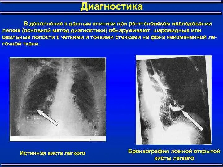 Как называется исследование легких. Как называется исследование легких