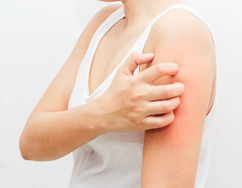 Сухость и зуд кожи всего тела причины. Покраснение кожи на руках и жжение. Сухость и зуд кожи всего тела причины. Сухость и зуд кожи всего тела причины. Колинэргическая крапивниц.