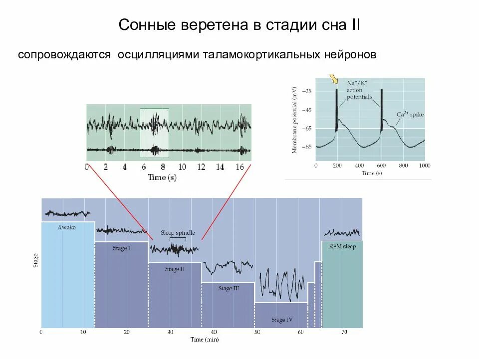 Веретена на ээг. Сонные веретена и к-комплексы на ээг. Фазы сна показатели ээг. Веретена сна на ээг. Веретена на ээг.