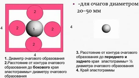 Где расположен очаг