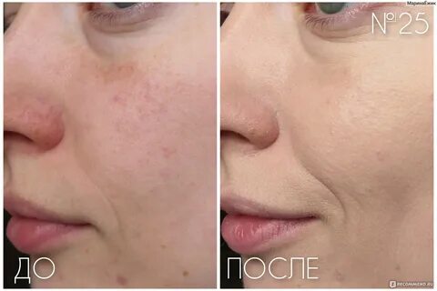 Skin evolution