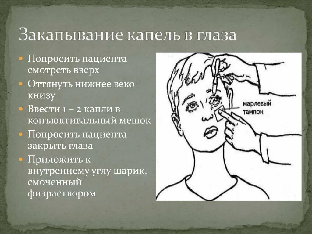 Уход за глазами алгоритм. Техника закапывания капель в глаза нос уши. Закапывание капель в глаза нос уши алгоритм. Введение капель в глаза алгоритм. Введение капель в нос алгоритм.