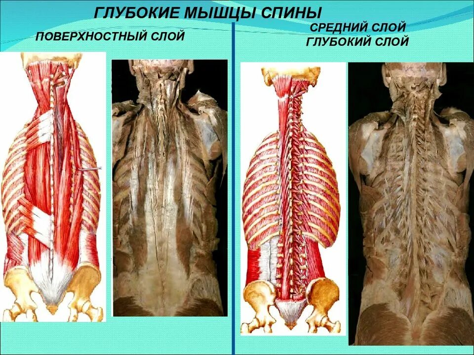 Мышцы спины глубокие и поверхностные анатомия. Мышцы спины анатомия 2 слой. Глубокие мышцы позвоночника анатомия. Глубокие мышцы спины.