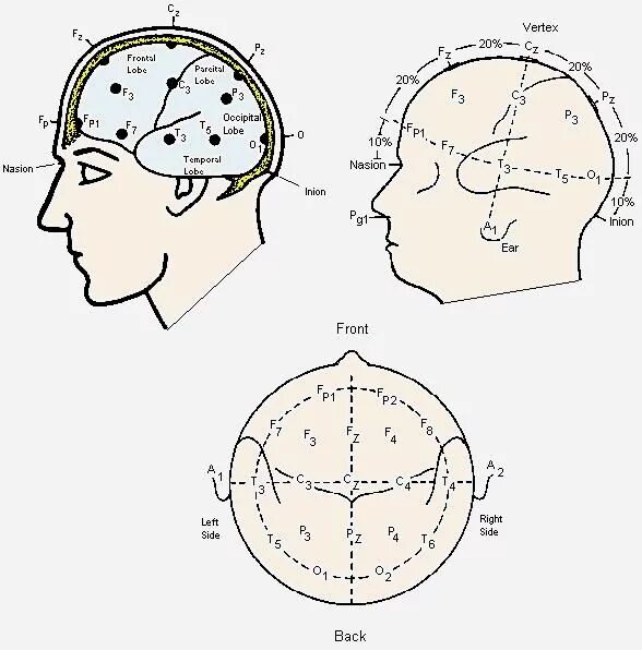 Система ээг. ЭЭГ наложение электродов схема 10-20. ЭЭГ методика наложения электродов. Схема наложения электродов ЭЭГ. Схема 10 20 при ЭЭГ.