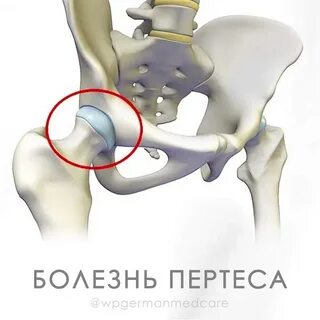 Суставы нижних конечностей и тазобедренного сустава