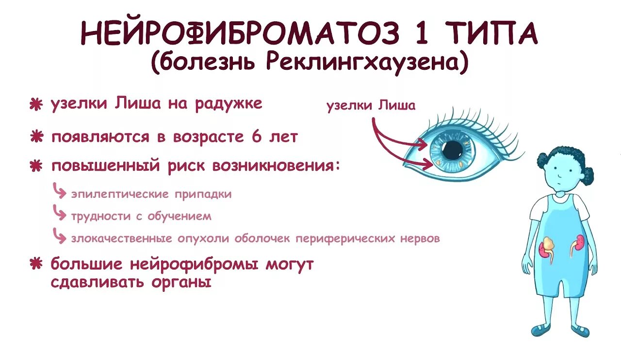 Проявление нейрофиброматоза