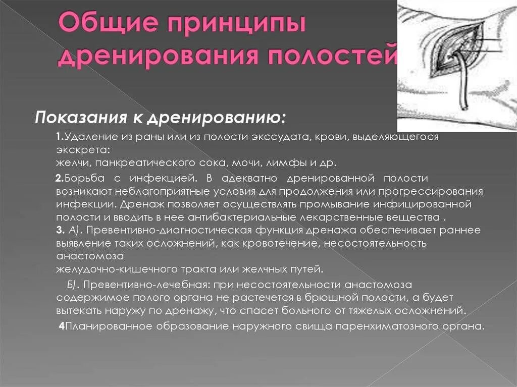 Через сколько снимать дренаж. Принципы дренирование полостей и РАН. Дренирование РАН И полостей хирургия. Показания к дренированию РАН И полостей. Принципы дренирования в хирургии.