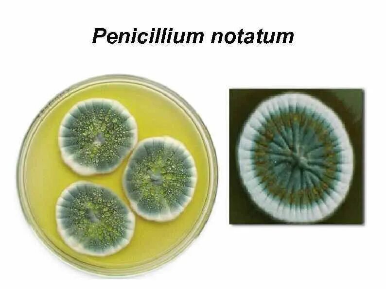 Плесневые грибы и антибиотики. Penicillium notatum пенициллин. Плесневого грибка рода Penicillium. Penicillium notatum chrysogenum. Штаммы Penicillium chrysogenum.