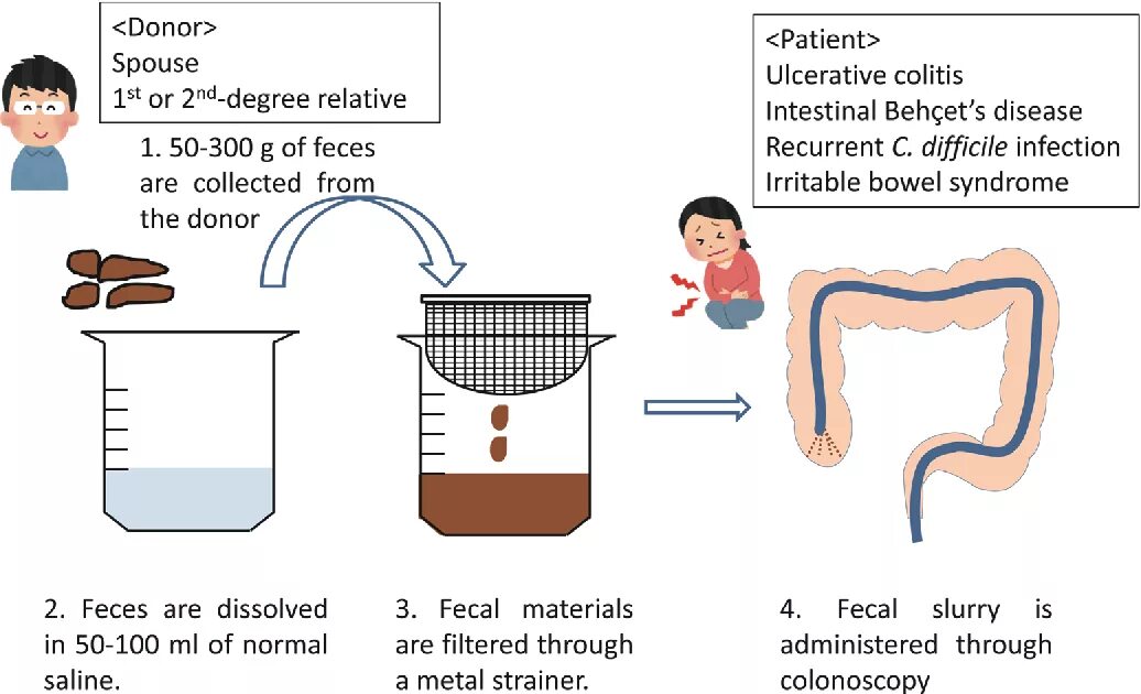 Пересадка микробиоты. Fecal microbiota transplantation терапия. трансплантация микробиоты кишечника. трансплантация фекальной микробиоты в домашних условиях.