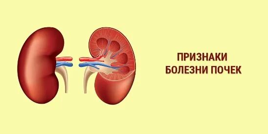 Как проявляется болезнь почек у мужчин. Симптомы заболевания почек. Признаки болезни почек.