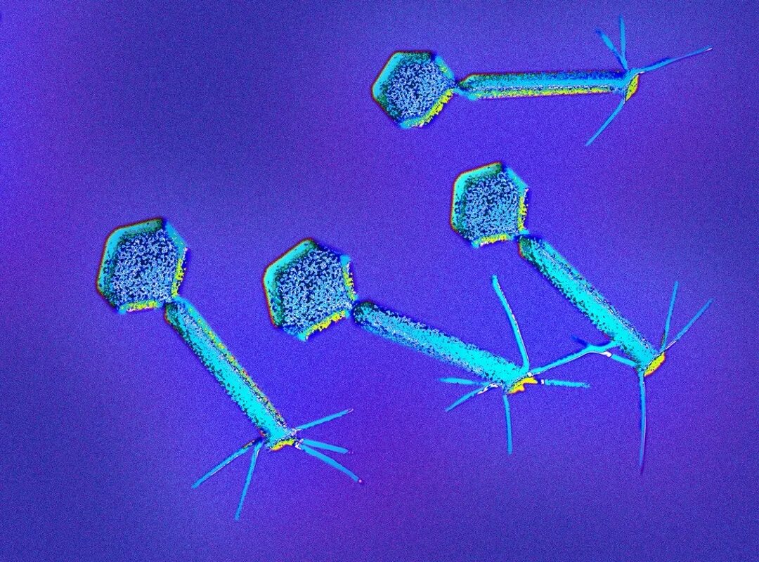 Вирус бактериофаг под микроскопом. Вирус бактериофаг микроскоп. Холерный бактериофаг микробиология. Бактериофаг т4.