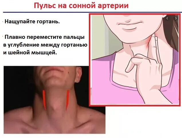 Как определить сонную артерию правильно. Как определить сонную артерию правильно