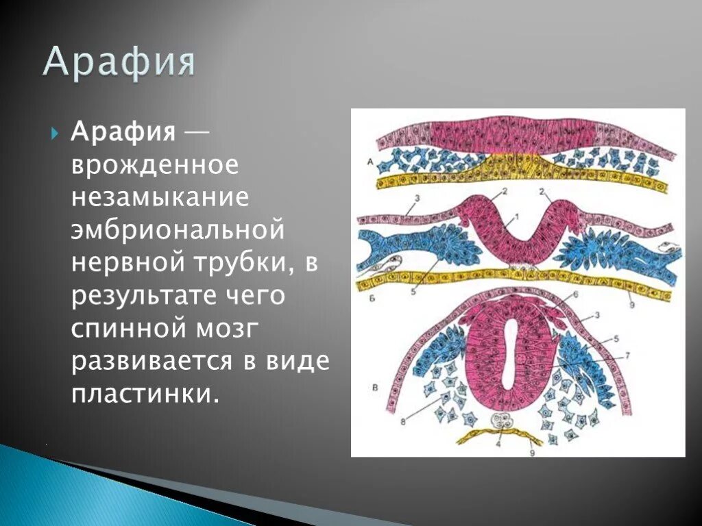 Который развивается из за