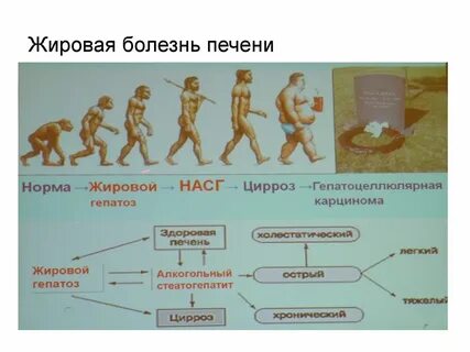 Заболевания связанные с метаболизмом