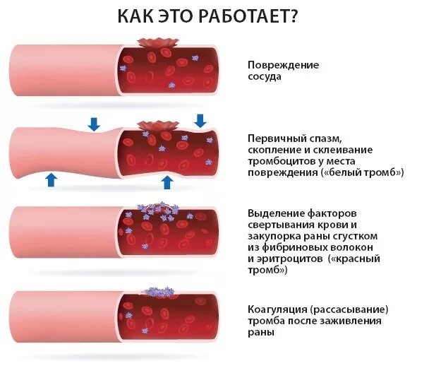 Почему при анализе свернулась кровь. Сосудистый механизм свертываемости крови. Механизмы повреждения стенки сосудов. Тромбоциты повреждение сосуда схема. Методом коагуляции повреждённых сосудов.