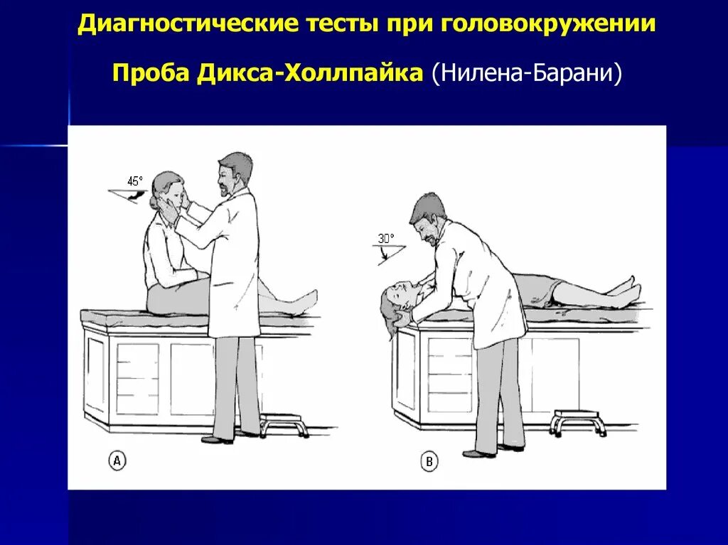 Проба холпайка. Проба Дикса-Холпайка. ДППГ проба Дикса Холлпайка. Проба Дикса-Холлпайка при ДППГ. Позиционные пробы при головокружении.