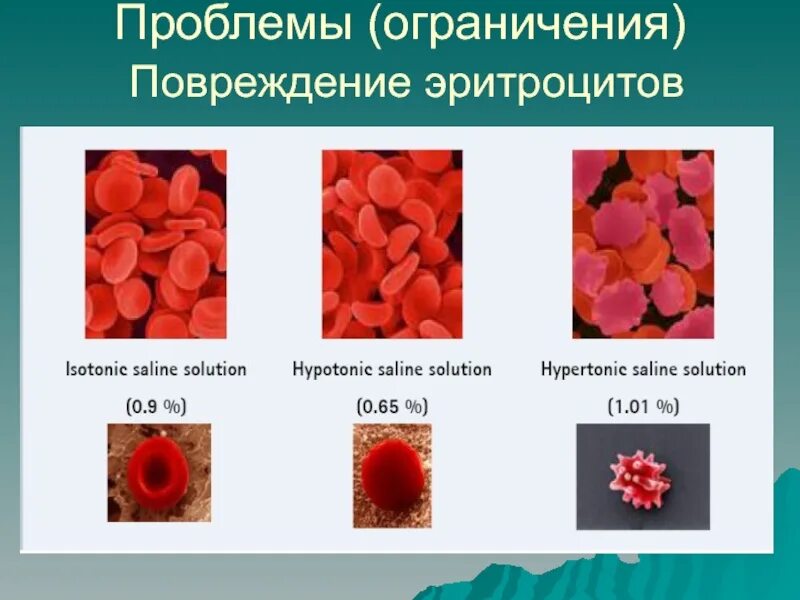Здоровый эритроцит. Эритроциты поврежденные. как выглядят эритроциты. эритроциты в разной среде.