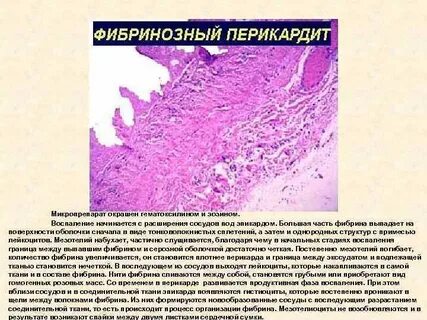 Фиброзное воспаление