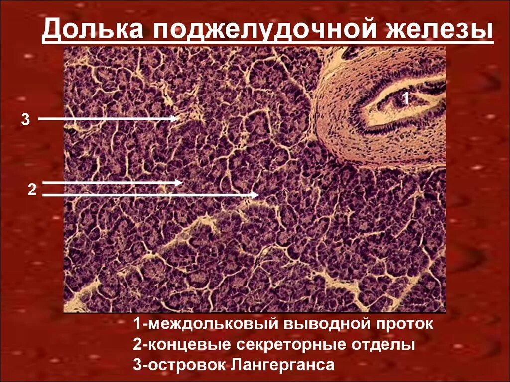 Эпителий печени и поджелудочной железы. Долька поджелудочной железы гистология. Выводной проток поджелудочной железы препарат. Поджелудочная гистология. Аберрантная долька поджелудочной железы.