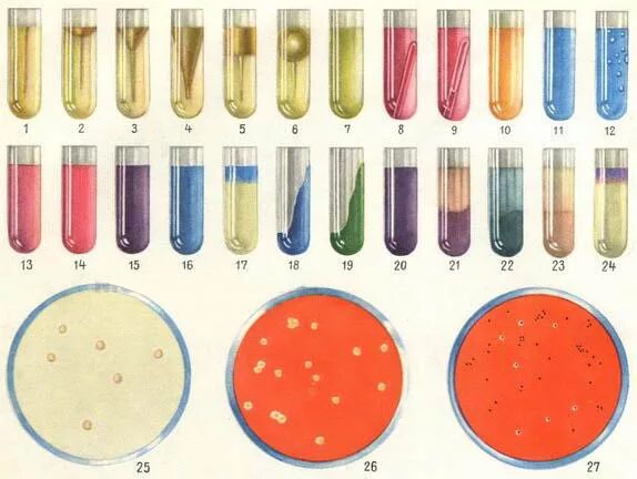 Питательная среда олькеницкого. Плесень. Дифференциально-диагностические питательные среды. Среда раппопорта сальмонеллы. Флакон с питательной средой для крови.
