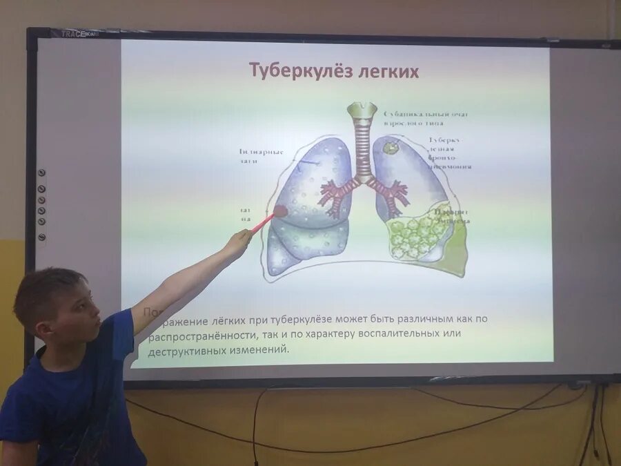 Туберкулез 2022 года. Месячник борьбы с туберкулезом. Месячник по туберкулезу. Месячник по борьбе с туберкулезом. Месячник туберкулеза в 2022 году.