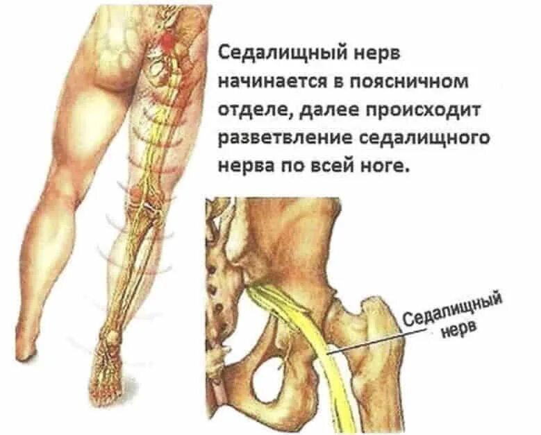 Нерв в правой ягодице. Нервно седалищный нерв. Воспаление седалищного нерва. Седалищный нерв анатомия\ядра. Седалищный нерв слева.