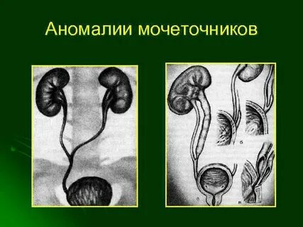 Мочеточник у плода
