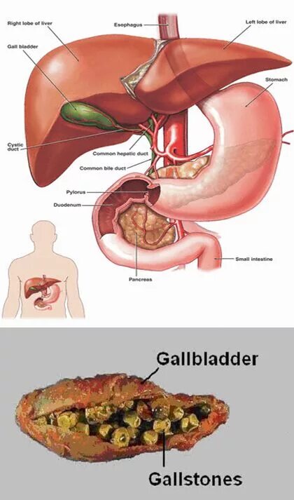 Желчный пузырь картинки у человека. Желчный пузырь где находится. Расположение желчного пузыря у человека. Желчный пузырь картинка. Расположение желчного пузыря у женщин.