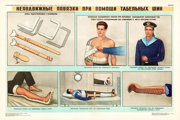 Первая помощь шины и повязки. Шина для оказания первой помощи. фиксирующие неподвижные повязки транспортные шины. наложение шин и повязок.