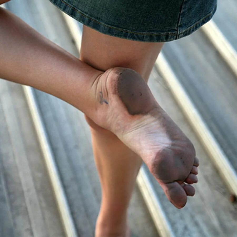 Красивые пятки. Пятки девушек история. Красивые грязные ступни. Пятки девушек история. Женские пяточки.