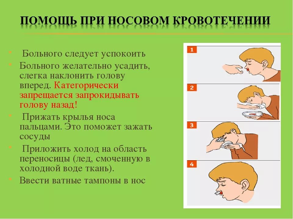 Первая помощь при носовом кровотечении. Первая помощь при носокровотечении. Первая помощь при мозговом кровотечение. Первая помощи при носовпом кровотечении. Необходимые действия при носовом кровотечении