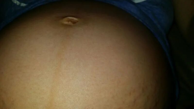 Belly popping