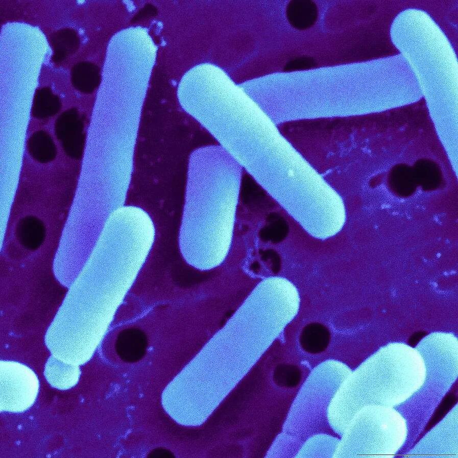 Палочка бифидобактерии. Лактобацилус Ацидофилус. Лактобациллы бактерии. Молочнокислые бактерии лактобациллы. Lactobacillus Acidophilus в микроскопе.
