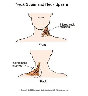 Neck 1
