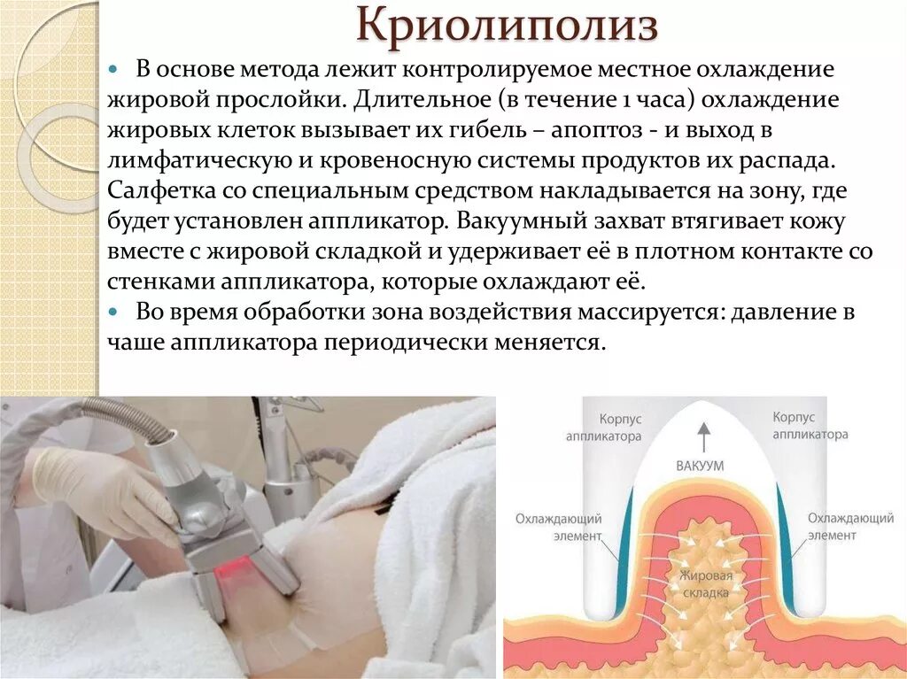 Криолиполиз что это отзывы. Криолиполиз. Криолиполиз метод. Криолиполиз методика проведения. Аппаратная косметология криолиполиз.