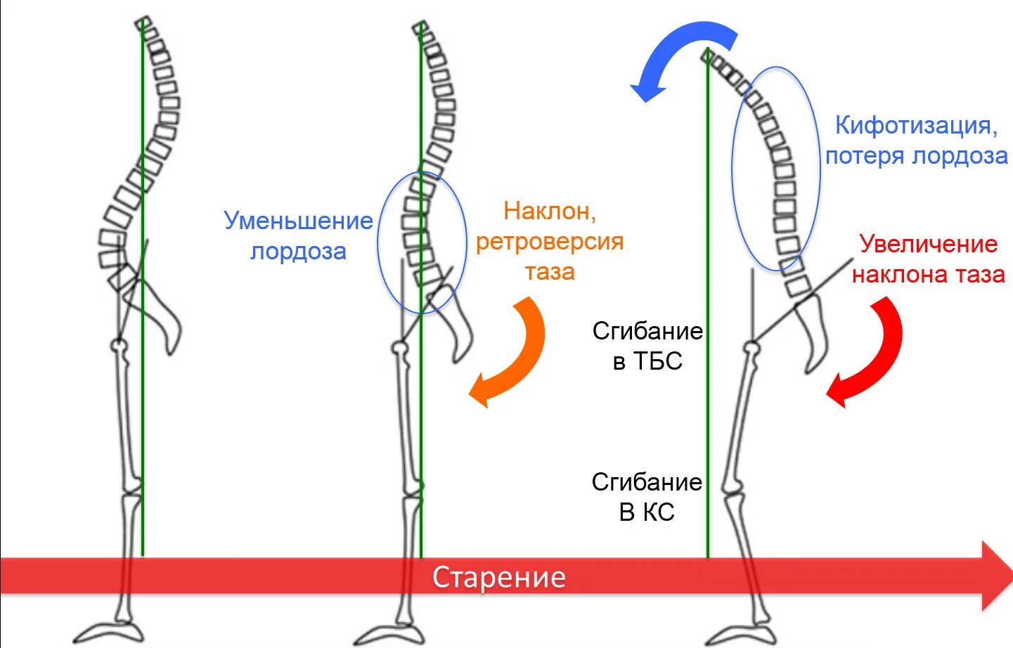 Поясничный лордоз упражнения. Норма лордоза в поясничном отделе. Лордоз кифоз норма. Управления при лордозе поясничного отдела позвоночника. Щенок по имени лордоз