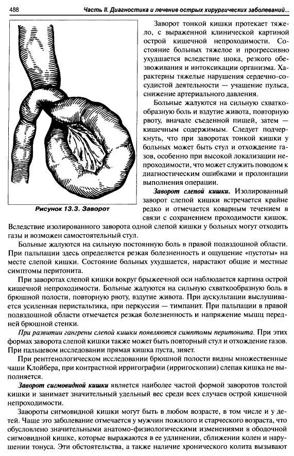 Заворот кишок и узлообразование. Заворот сигмовидной кишки клиника. Заворот петель тонкого кишечника. Симптомы операция кишечнике